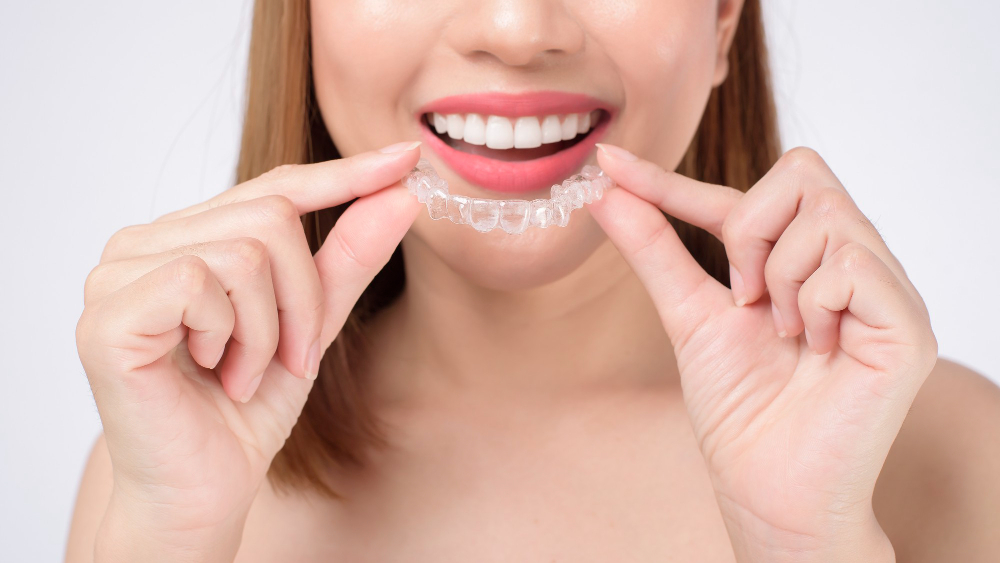 INVISALIGN 7 Invisalign